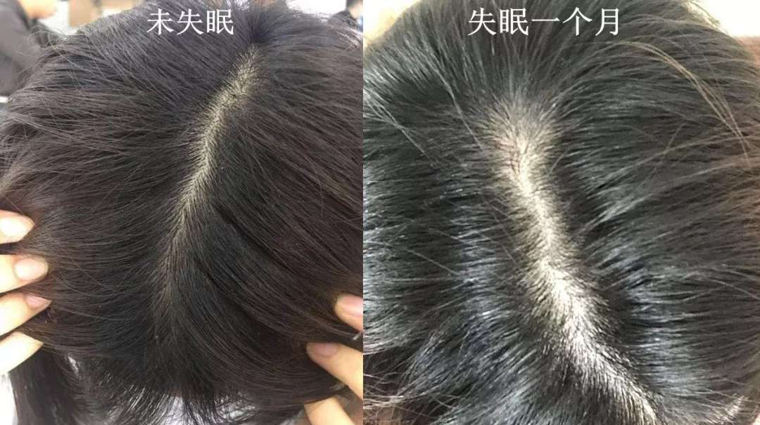 障碍睡眠亚健康的原因_障碍睡眠亚健康的表现_亚健康睡眠障碍